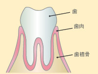 1．歯肉炎